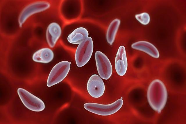 Zrozumienie zakażenia Toxoplasma gondii u kotów i psów: objawy, diagnoza i leczenie