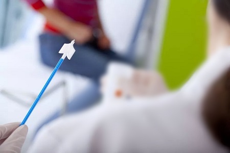Postępy w badaniu badań nad rakiem szyjki macicy: rola samookaleczenia testów HPV