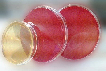 Agar Salmonella Shigella (SS): Podstawowa pożywka izolacji patogenu