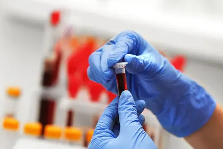 Szybkie wykrywanie malarii: zestaw do podwójnego testu antygenowego BABIO wzmacnia zdrowie na całym świecie