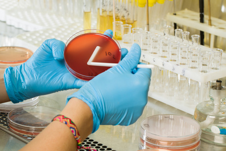 Podłoże agarowe MacConkeya firmy BABIO – najwyższej jakości selektywna izolacja do globalnej diagnostyki mikrobiologicznej